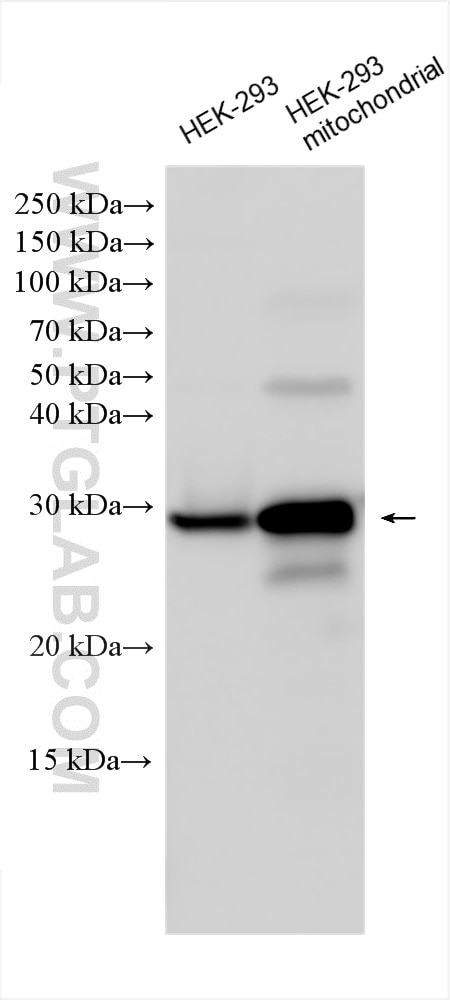 Western Blot (WB) analysis of various lysates using MRPL10 Polyclonal antibody (16652-1-AP)