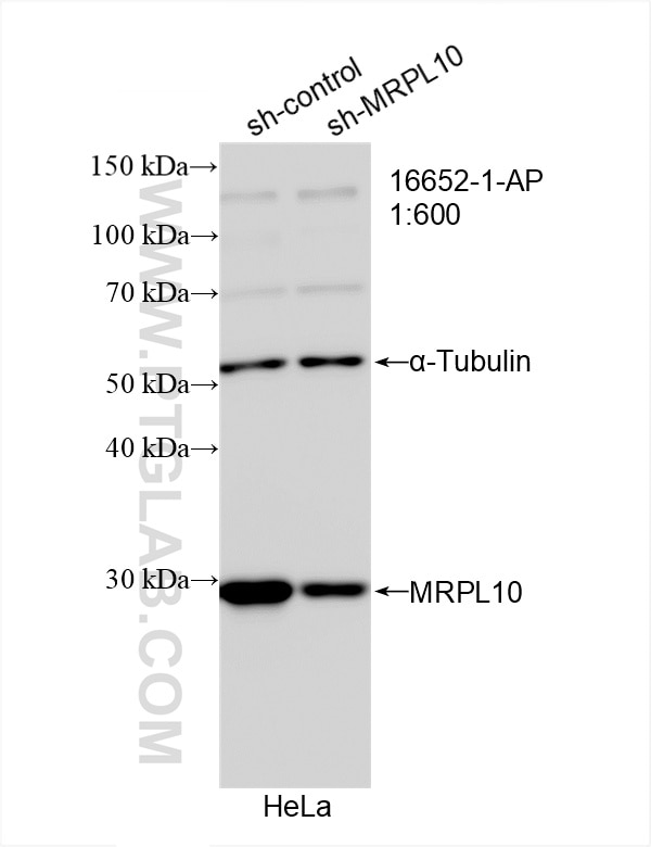 Western Blot (WB) analysis of HeLa cells using MRPL10 Polyclonal antibody (16652-1-AP)