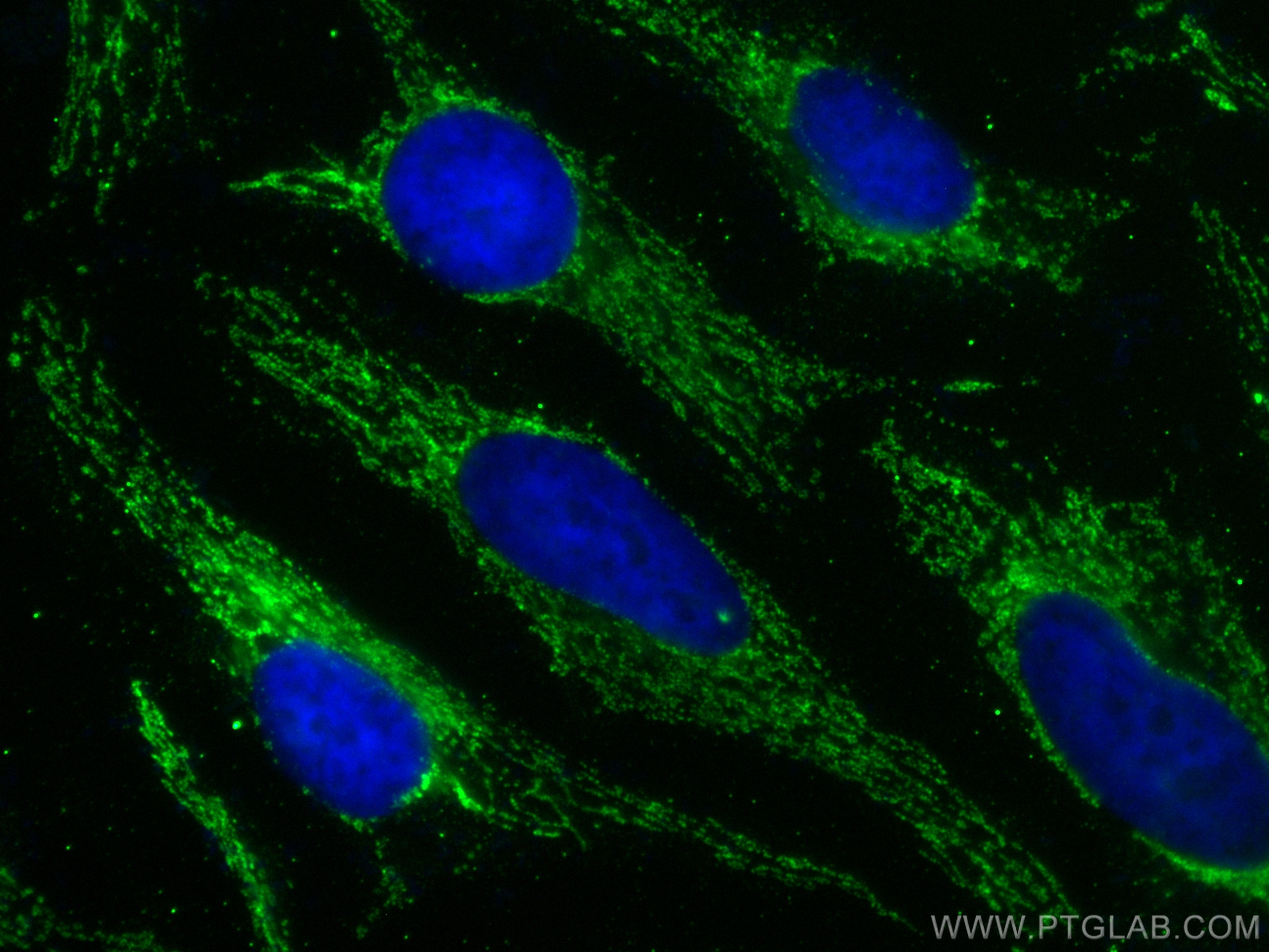 Immunofluorescence (IF) / fluorescent staining of HeLa cells using MRPL10 Monoclonal antibody (68623-1-Ig)