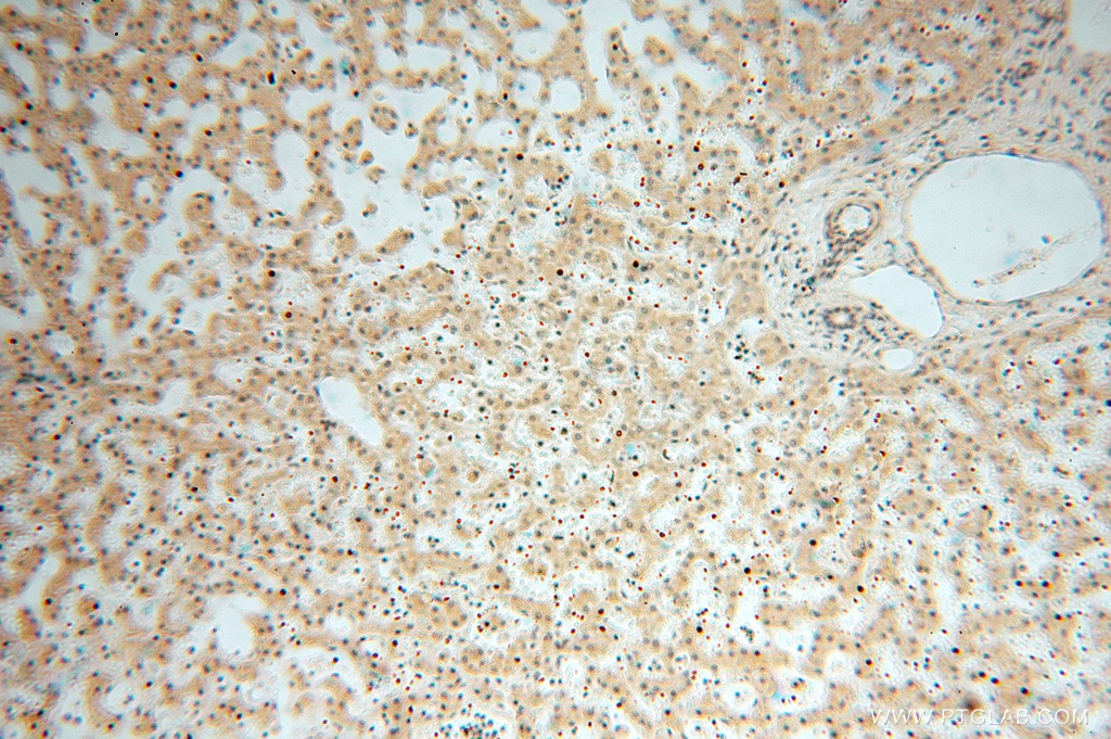 Immunohistochemistry (IHC) staining of human liver tissue using MRPL11 Polyclonal antibody (15543-1-AP)