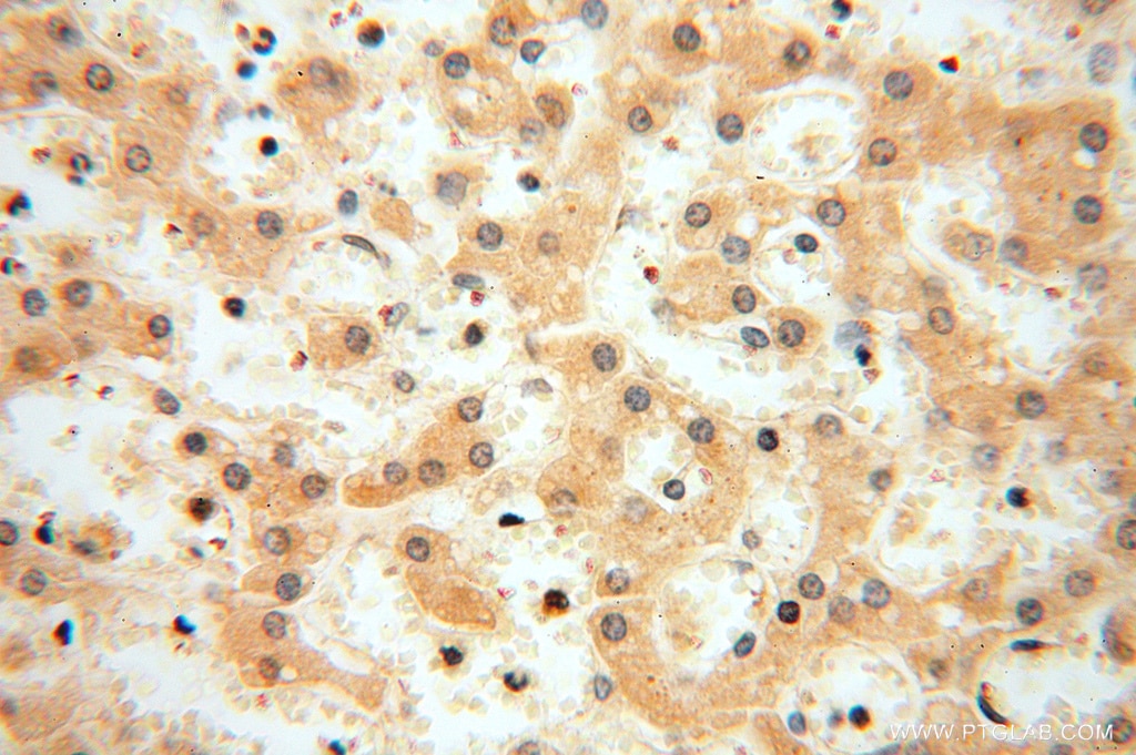 Immunohistochemistry (IHC) staining of human liver tissue using MRPL11 Polyclonal antibody (15543-1-AP)