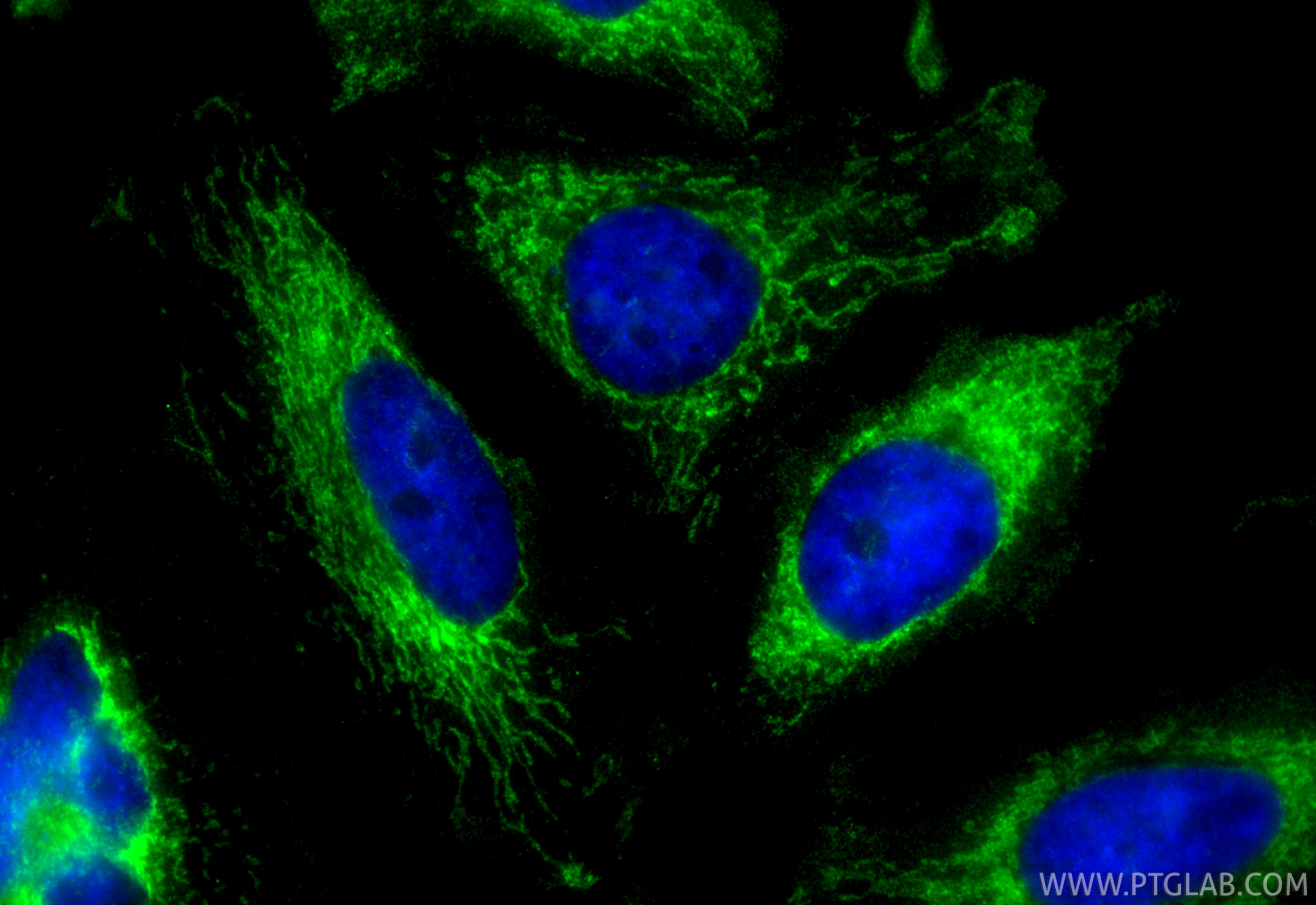 Immunofluorescence (IF) / fluorescent staining of HeLa cells using CoraLite® Plus 488-conjugated MRPL11 Recombinant a (CL488-85109-4)