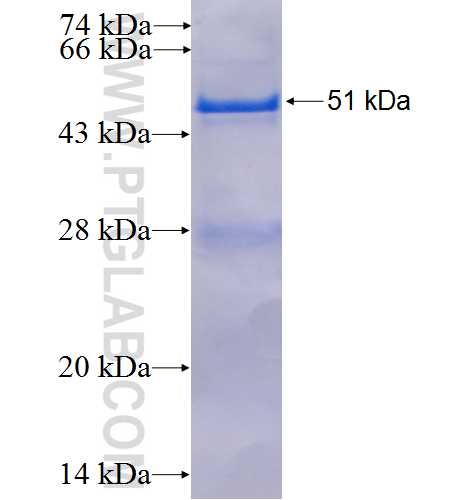 MRPL12 fusion protein Ag6504 SDS-PAGE