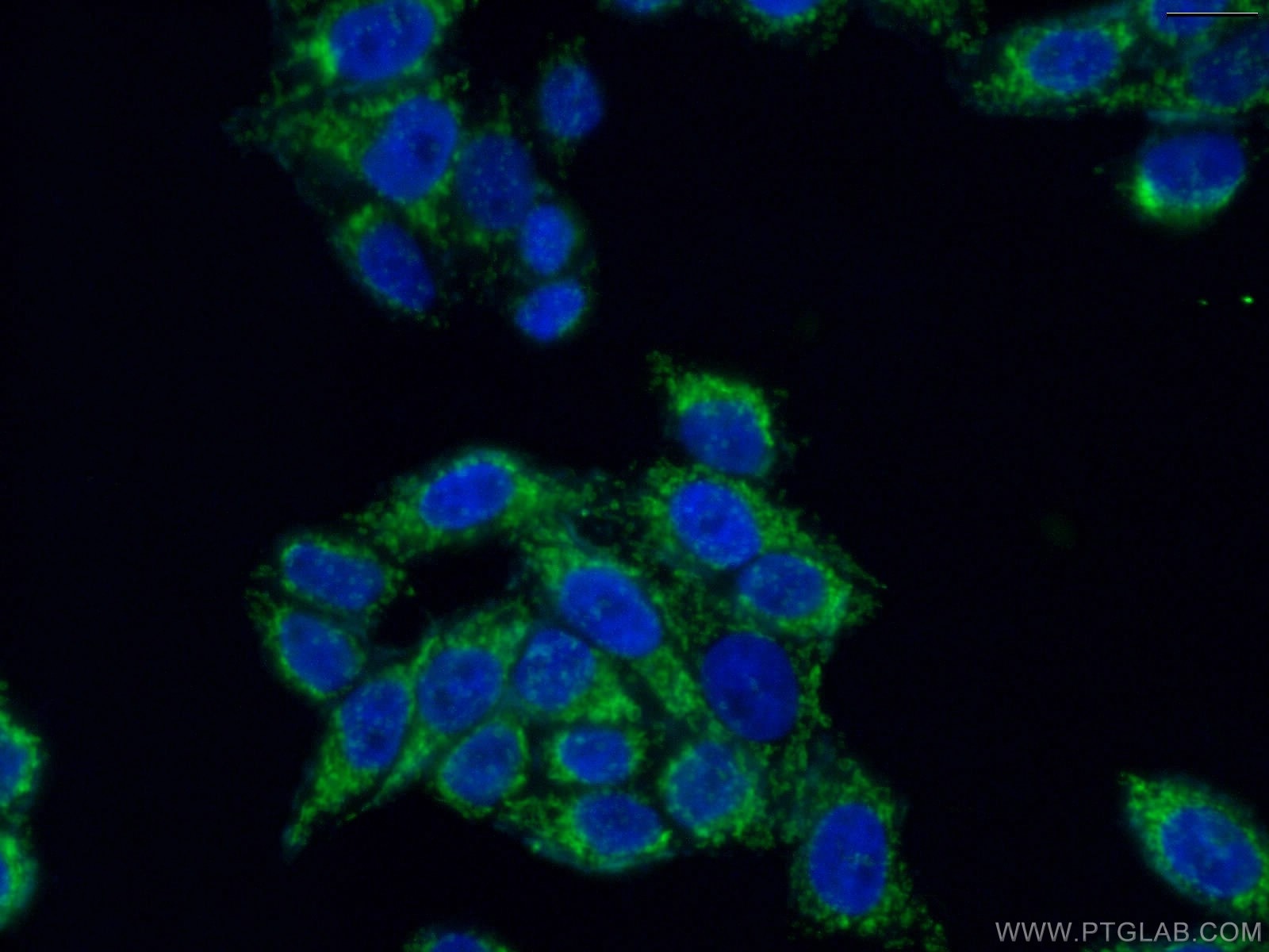 Immunofluorescence (IF) / fluorescent staining of HeLa cells using MRPL19 Polyclonal antibody (16517-1-AP)