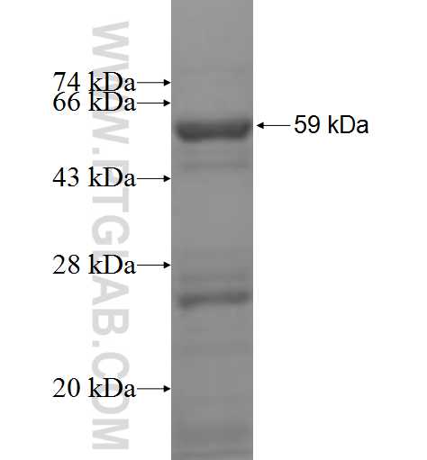 MRPL2 fusion protein Ag9618 SDS-PAGE