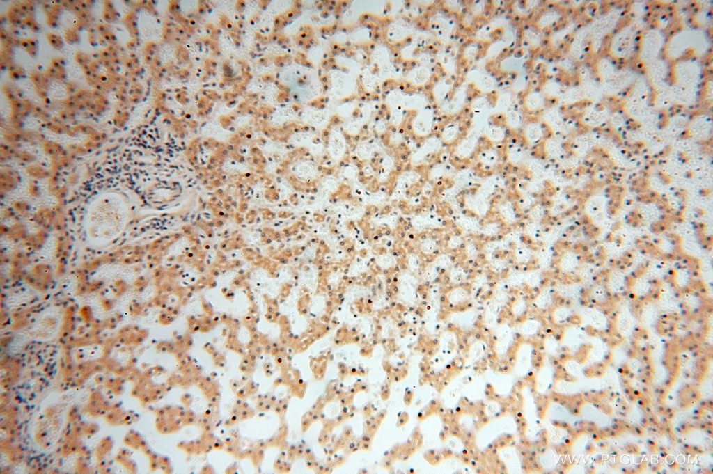Immunohistochemistry (IHC) staining of human liver tissue using MRPL21 Polyclonal antibody (16978-1-AP)