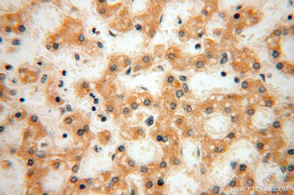 Immunohistochemistry (IHC) staining of human liver tissue using MRPL21 Polyclonal antibody (16978-1-AP)