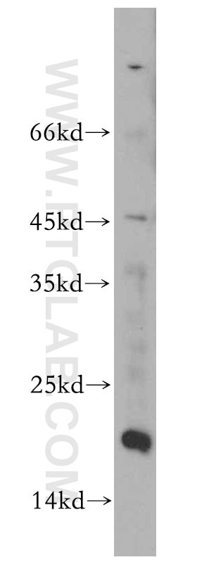 Western Blot (WB) analysis of HeLa cells using MRPL23 Polyclonal antibody (11706-1-AP)