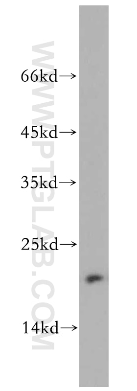 WB analysis of A2780 using 11706-1-AP