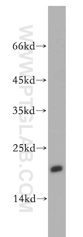 Western Blot (WB) analysis of A2780 cells using MRPL23 Polyclonal antibody (11706-1-AP)