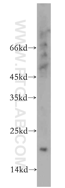 Western Blot (WB) analysis of MCF-7 cells using MRPL23 Polyclonal antibody (11706-1-AP)