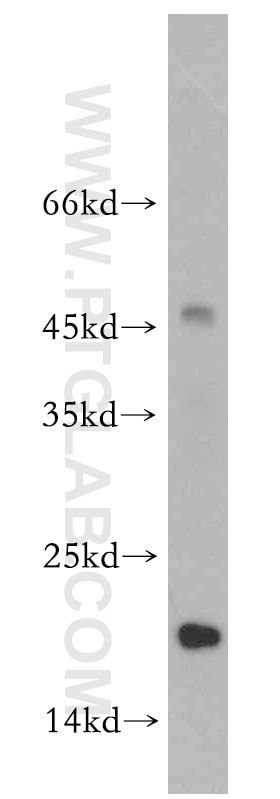 Western Blot (WB) analysis of MCF-7 cells using MRPL23 Polyclonal antibody (11706-1-AP)
