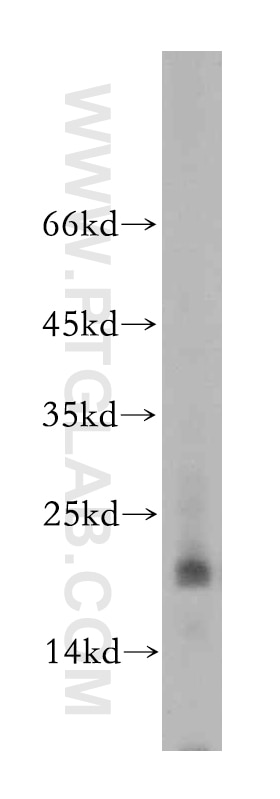 Western Blot (WB) analysis of HEK-293 cells using MRPL23 Polyclonal antibody (11706-1-AP)