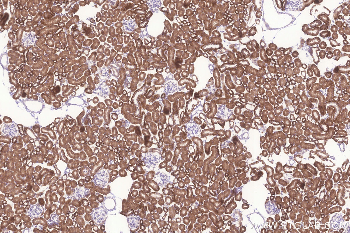 Immunohistochemistry (IHC) staining of mouse kidney tissue using MRPL23 Monoclonal antibody (66595-1-Ig)