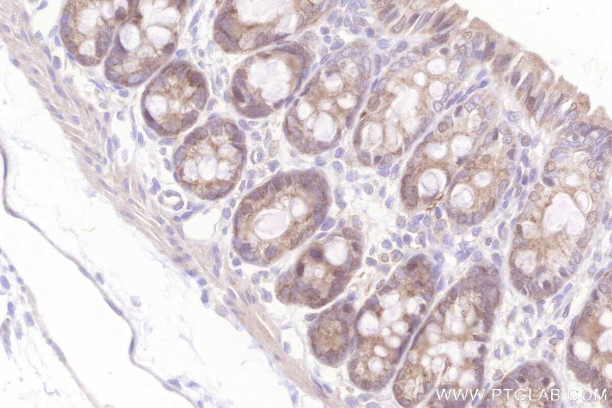 Immunohistochemistry (IHC) staining of rat colon tissue using MRPL23 Monoclonal antibody (66595-1-Ig)