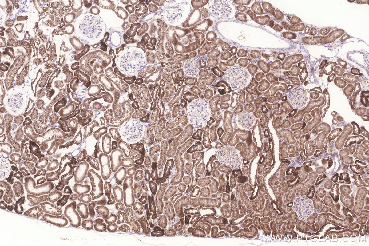 Immunohistochemistry (IHC) staining of rat kidney tissue using MRPL23 Monoclonal antibody (66595-1-Ig)
