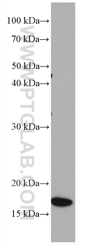 Western Blot (WB) analysis of HEK-293 cells using MRPL23 Monoclonal antibody (66595-1-Ig)