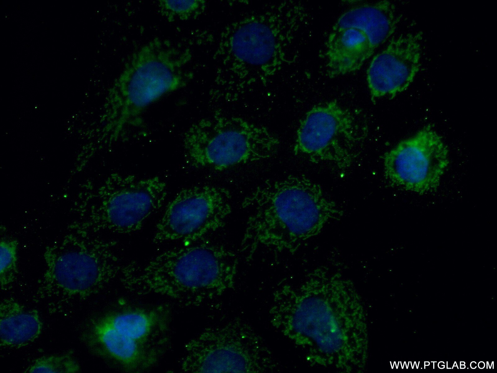 Immunofluorescence (IF) / fluorescent staining of A431 cells using MRPL27 Polyclonal antibody (14765-1-AP)