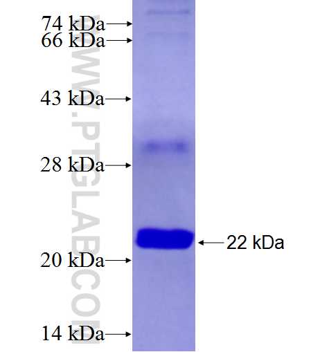 MRPL27 fusion protein Ag6870 SDS-PAGE