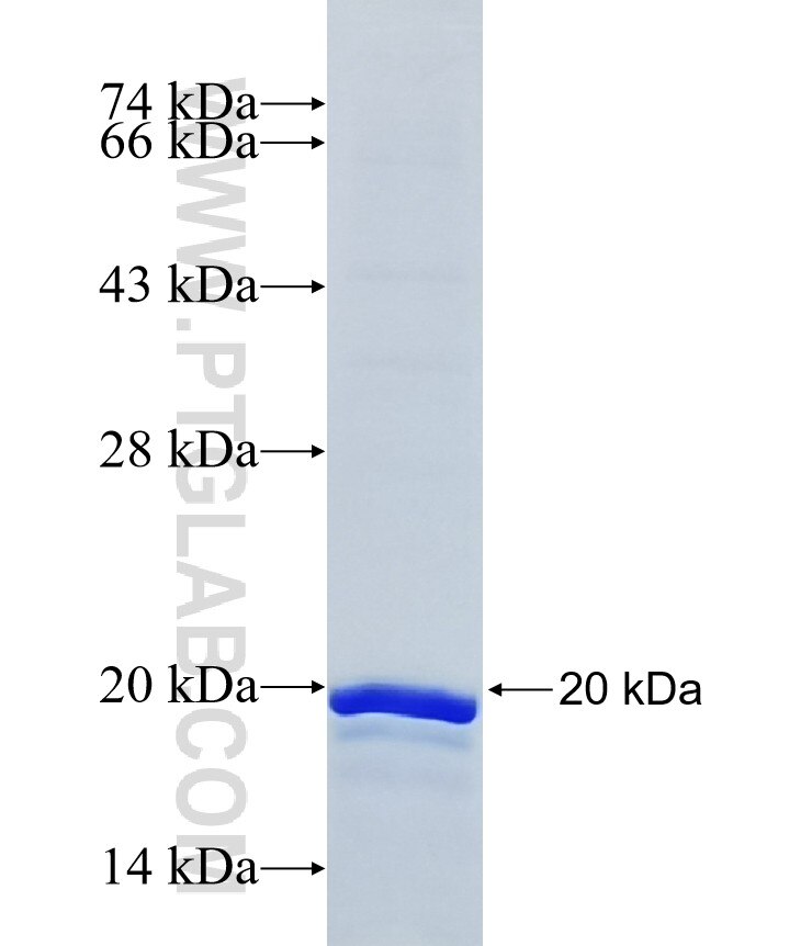 MRPL27 fusion protein Ag6870 SDS-PAGE