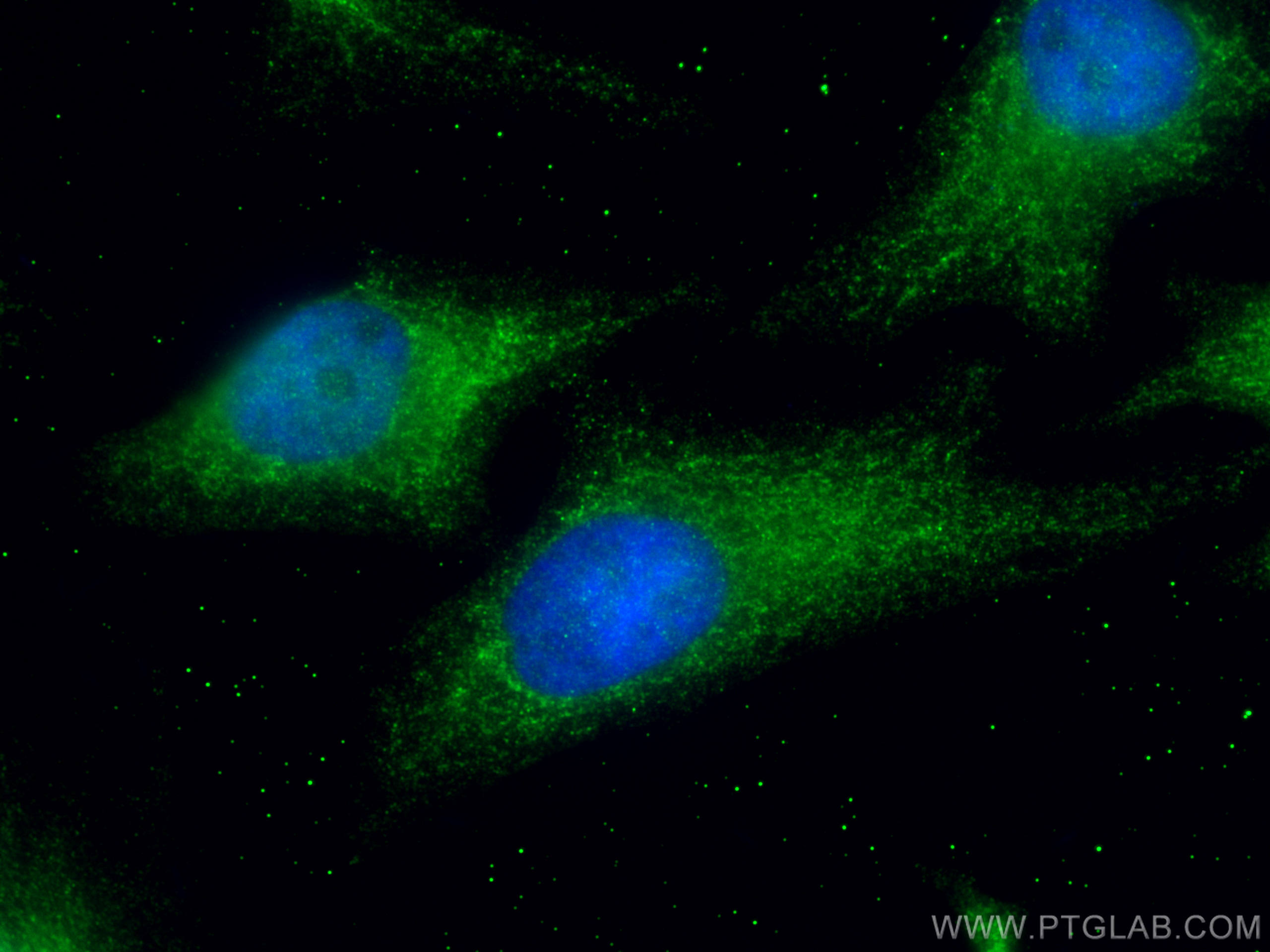 Immunofluorescence (IF) / fluorescent staining of HeLa cells using MRPL28 Polyclonal antibody (21604-1-AP)