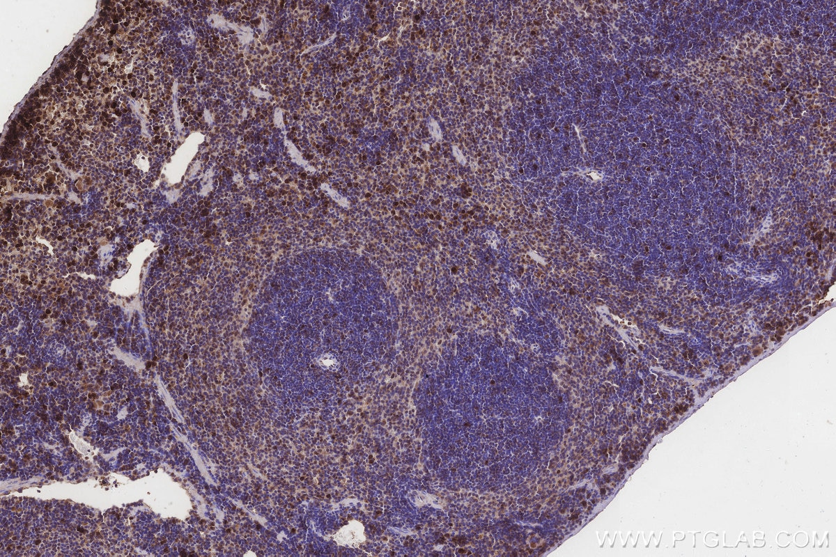 Immunohistochemistry (IHC) staining of mouse spleen tissue using MRPL28 Polyclonal antibody (21604-1-AP)