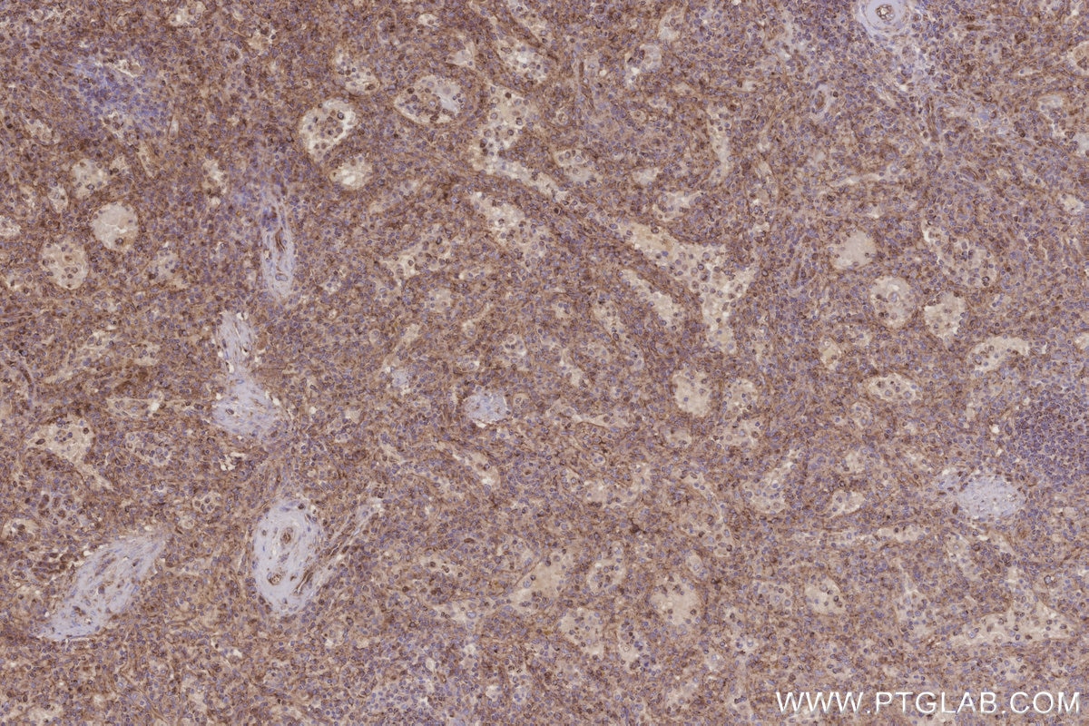 Immunohistochemistry (IHC) staining of human spleen tissue using MRPL28 Polyclonal antibody (21604-1-AP)