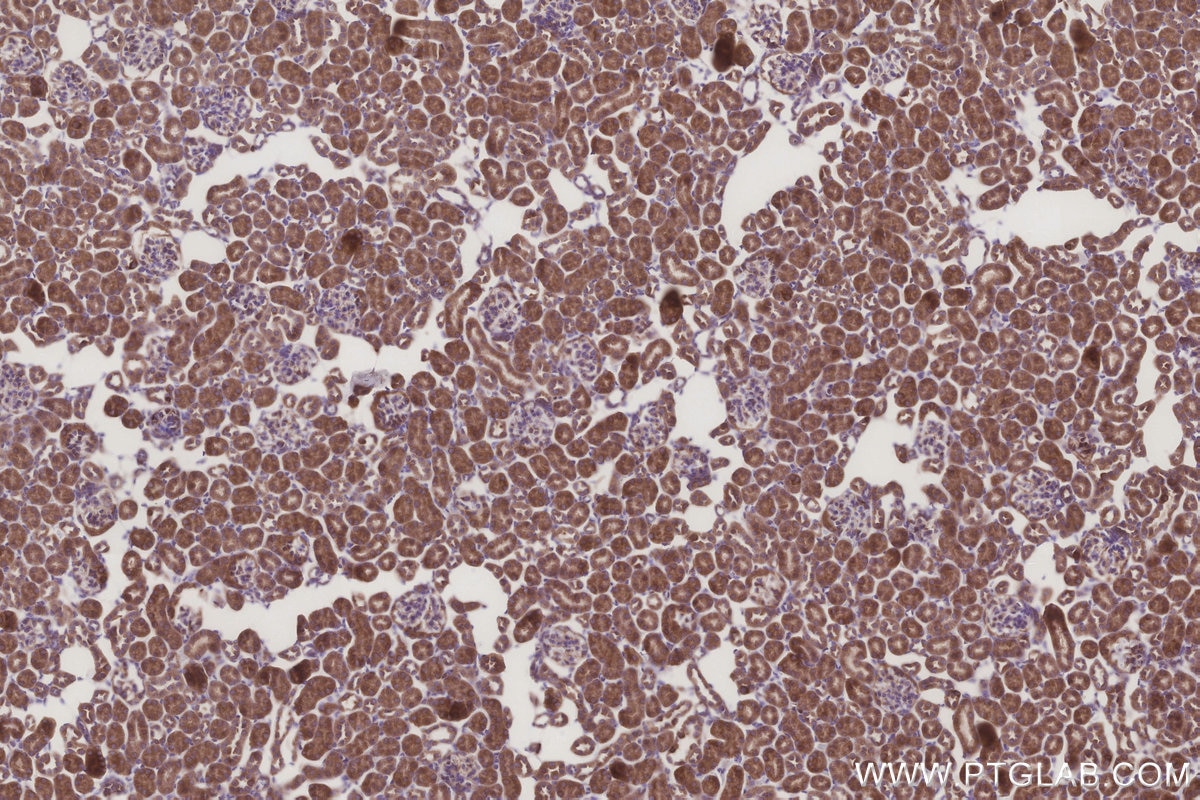 Immunohistochemistry (IHC) staining of mouse kidney tissue using MRPL28 Polyclonal antibody (21604-1-AP)