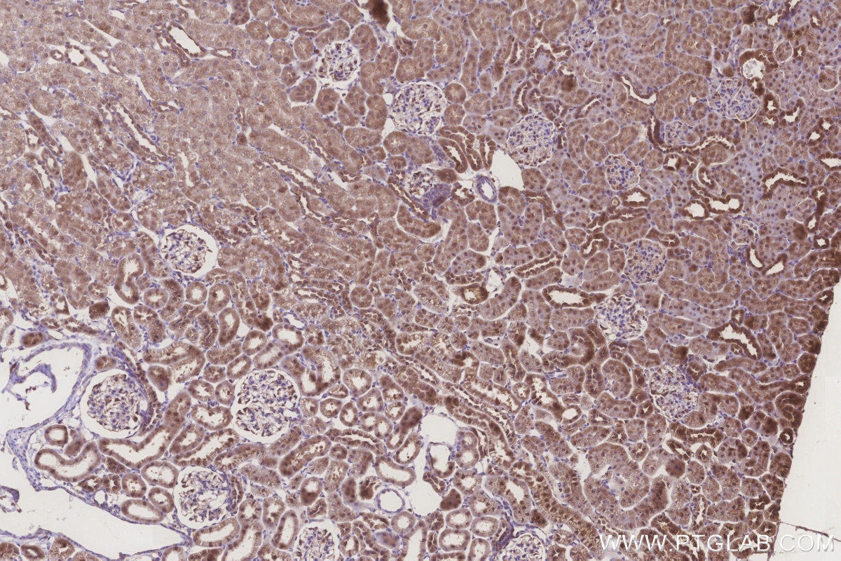 Immunohistochemistry (IHC) staining of rat kidney tissue using MRPL28 Polyclonal antibody (21604-1-AP)