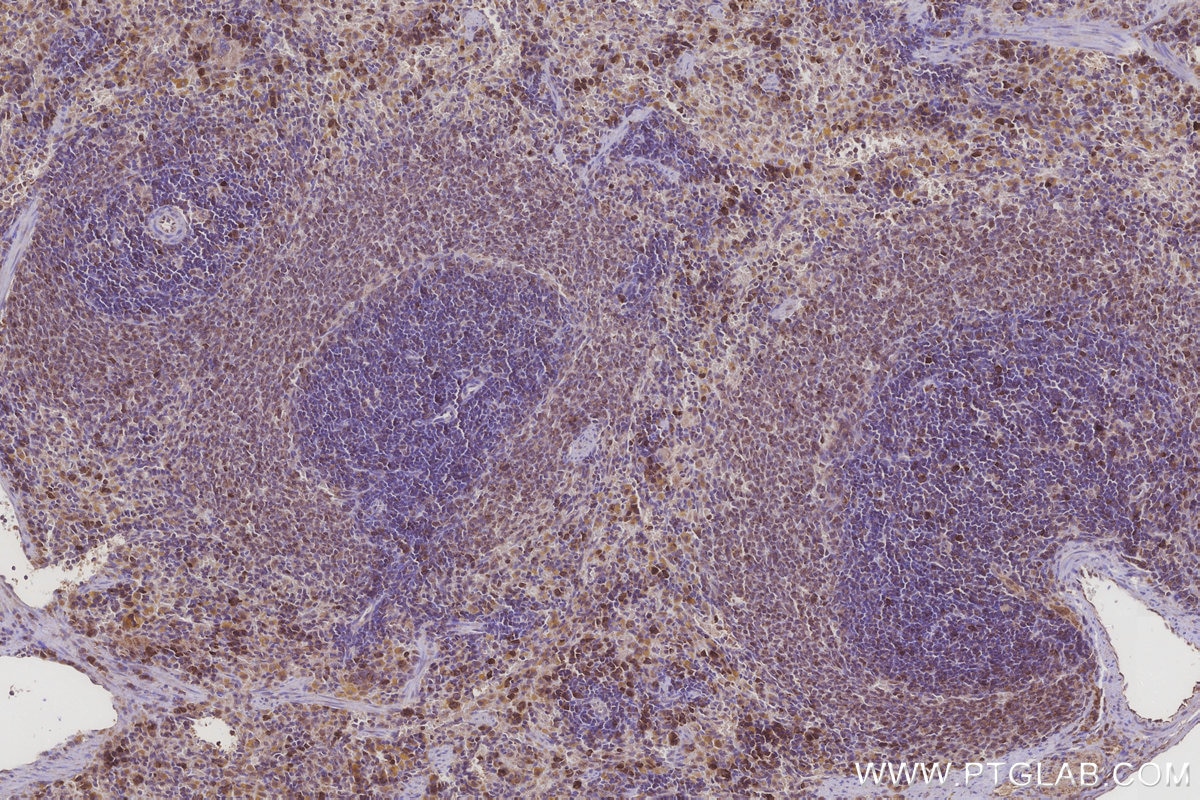 Immunohistochemistry (IHC) staining of rat spleen tissue using MRPL28 Polyclonal antibody (21604-1-AP)