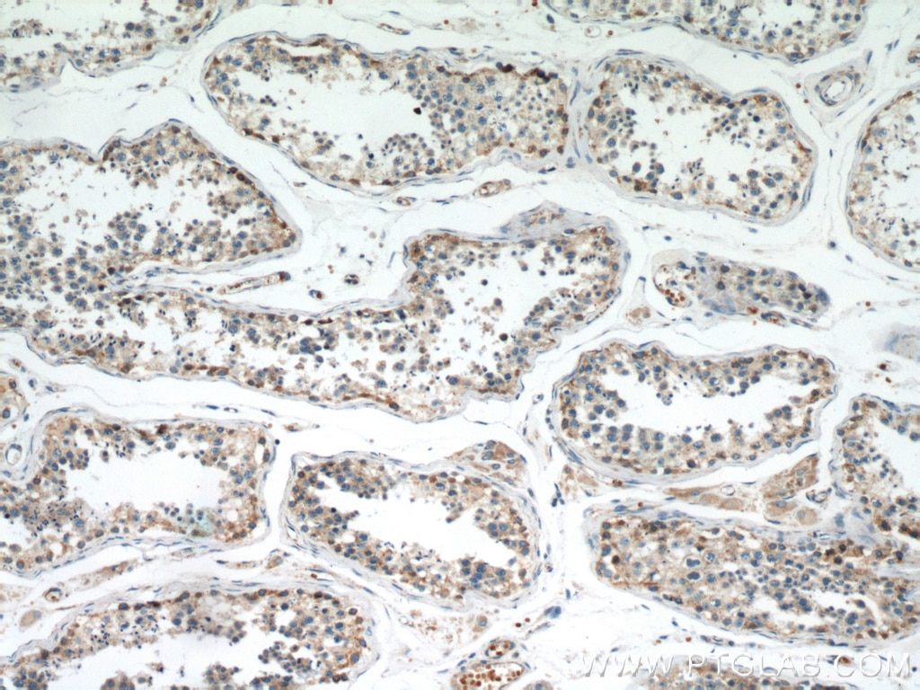 Immunohistochemistry (IHC) staining of human testis tissue using MRPL28 Polyclonal antibody (21604-1-AP)