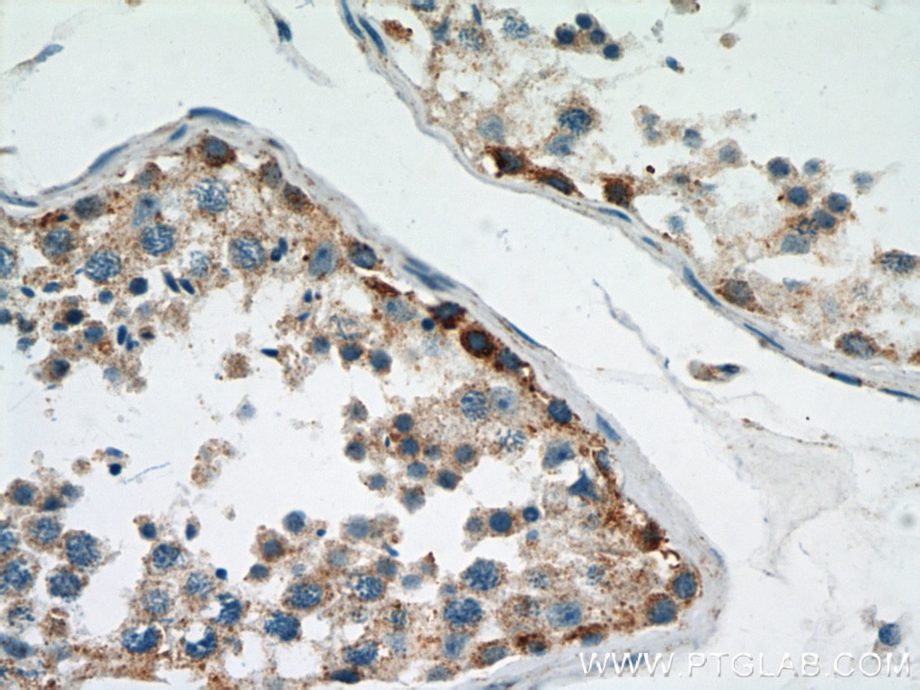 Immunohistochemistry (IHC) staining of human testis tissue using MRPL28 Polyclonal antibody (21604-1-AP)