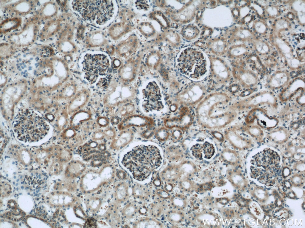 Immunohistochemistry (IHC) staining of human kidney tissue using MRPL28 Polyclonal antibody (21604-1-AP)