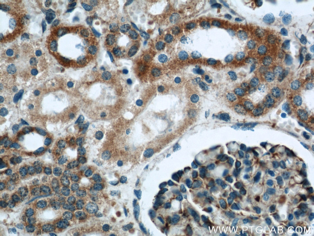 Immunohistochemistry (IHC) staining of human kidney tissue using MRPL28 Polyclonal antibody (21604-1-AP)