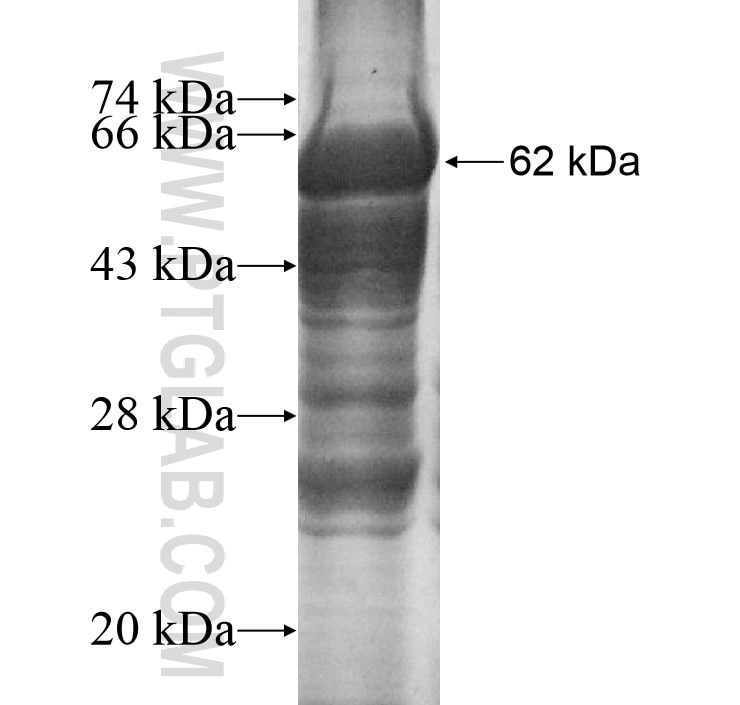 MRPL3 fusion protein Ag9970 SDS-PAGE