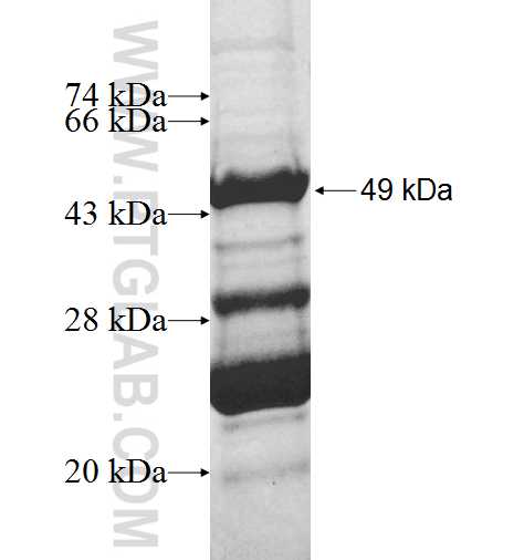 MRPL30 fusion protein Ag9778 SDS-PAGE