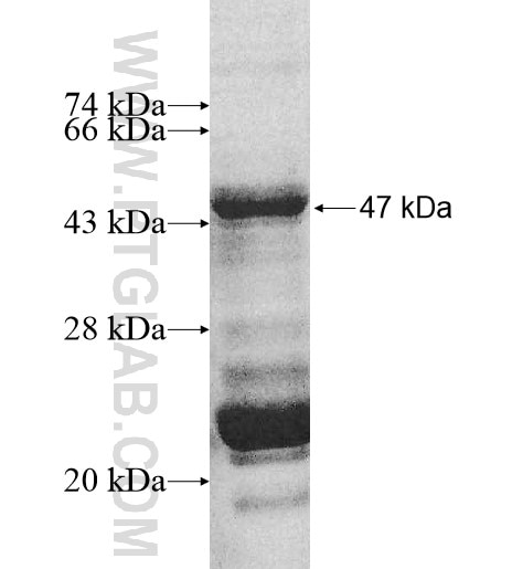 MRPL32 fusion protein Ag10775 SDS-PAGE