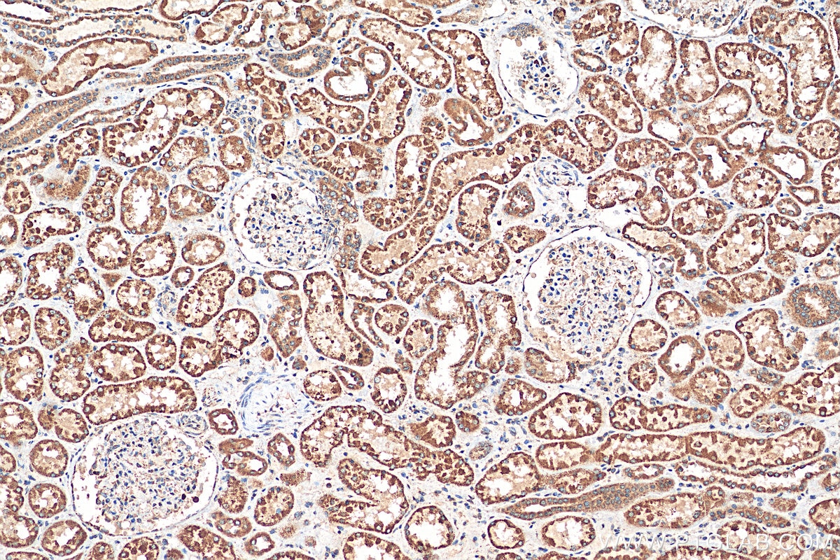 Immunohistochemistry (IHC) staining of human kidney tissue using MRPL33 Polyclonal antibody (23870-1-AP)