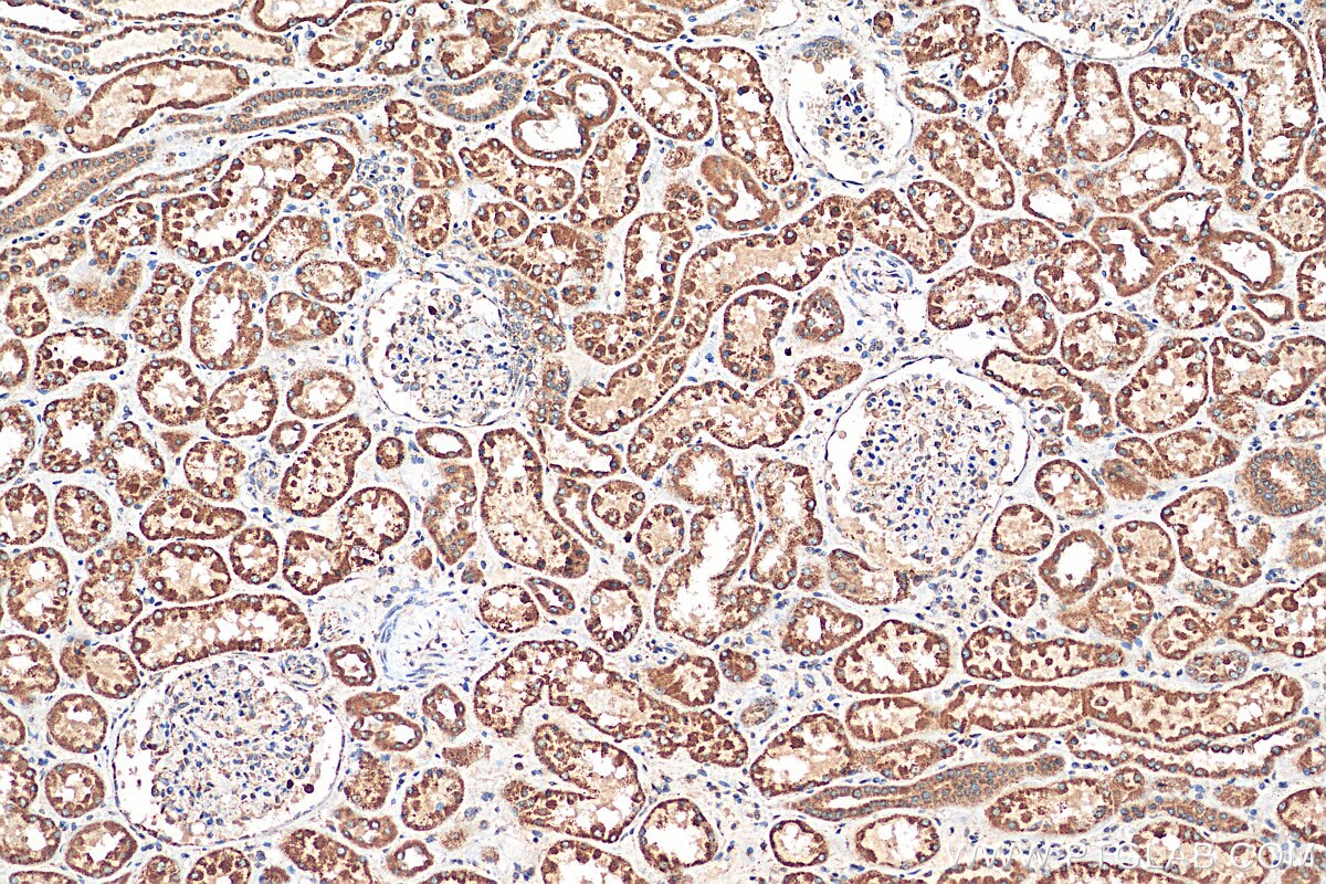 IHC staining of human kidney using 23870-1-AP