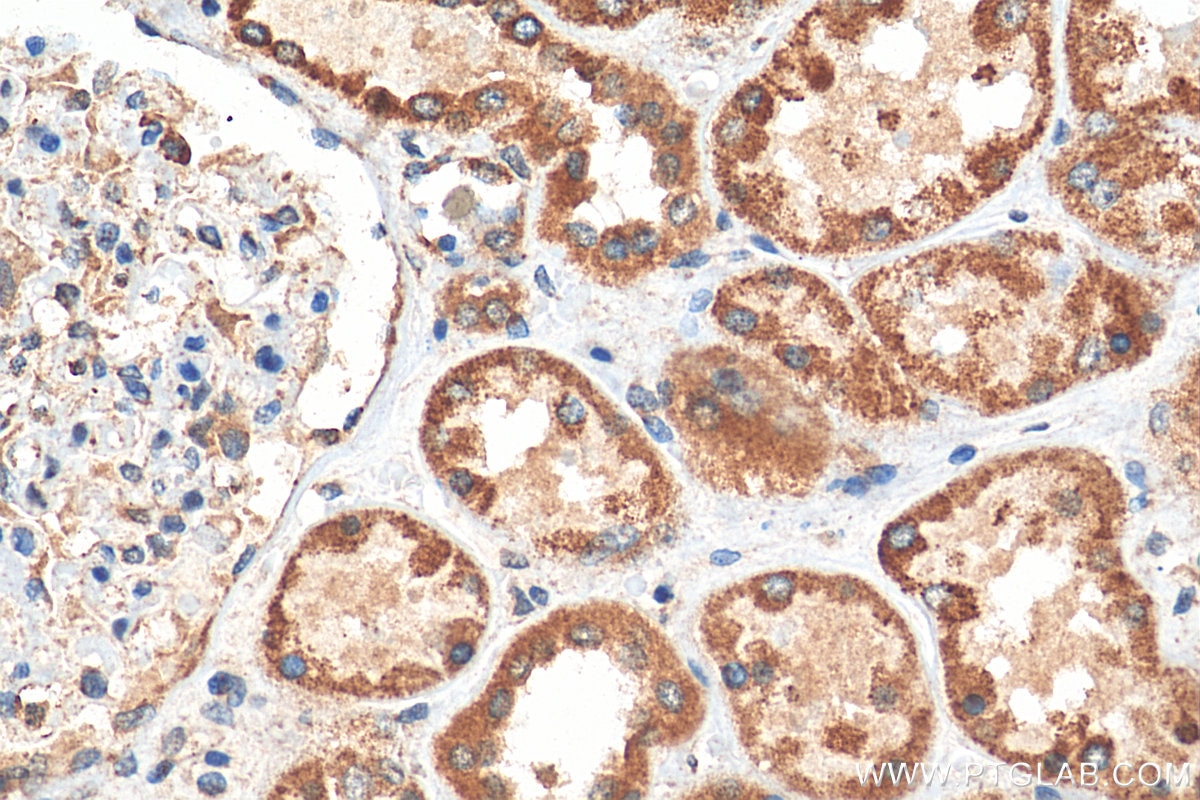 Immunohistochemistry (IHC) staining of human kidney tissue using MRPL33 Polyclonal antibody (23870-1-AP)