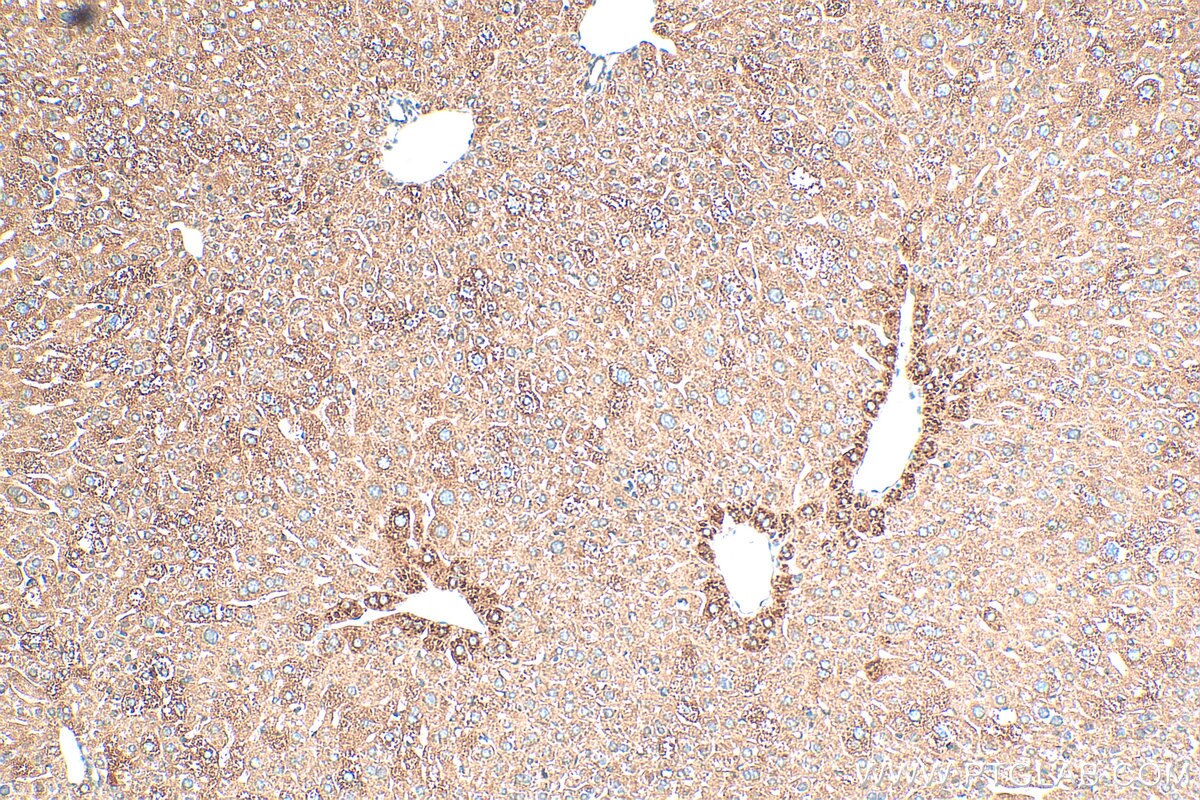Immunohistochemistry (IHC) staining of mouse liver tissue using MRPL35 Polyclonal antibody (27339-1-AP)