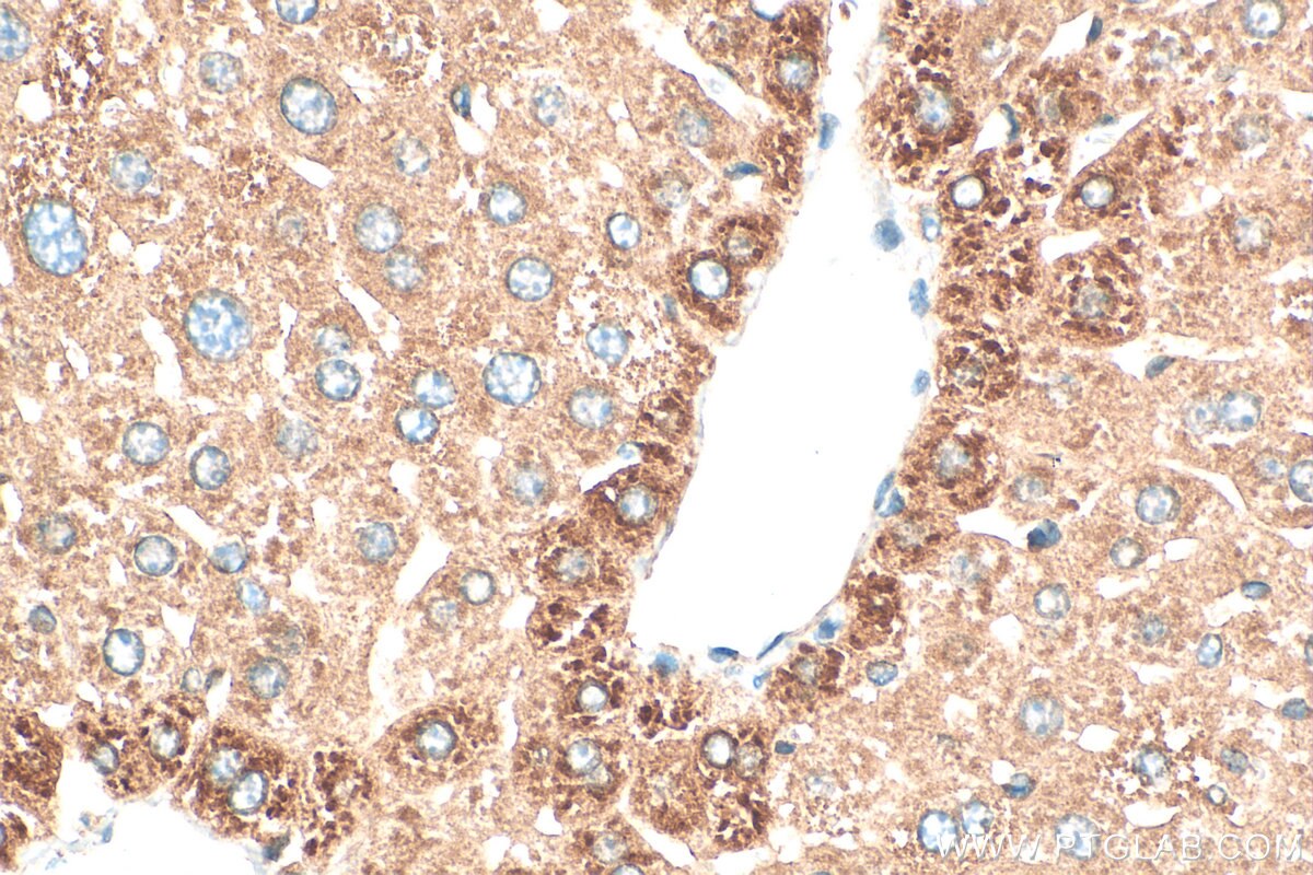 Immunohistochemistry (IHC) staining of mouse liver tissue using MRPL35 Polyclonal antibody (27339-1-AP)