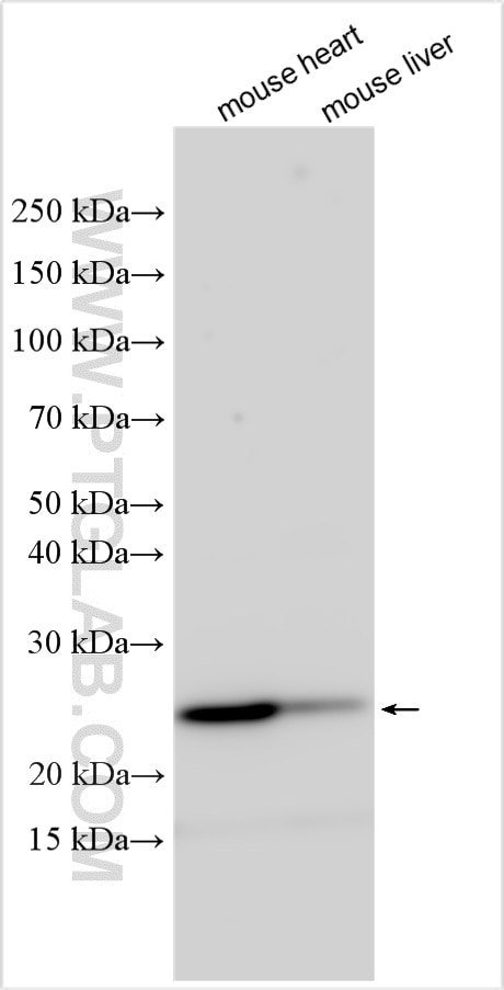 Western Blot (WB) analysis of various lysates using MRPL35 Polyclonal antibody (27339-1-AP)