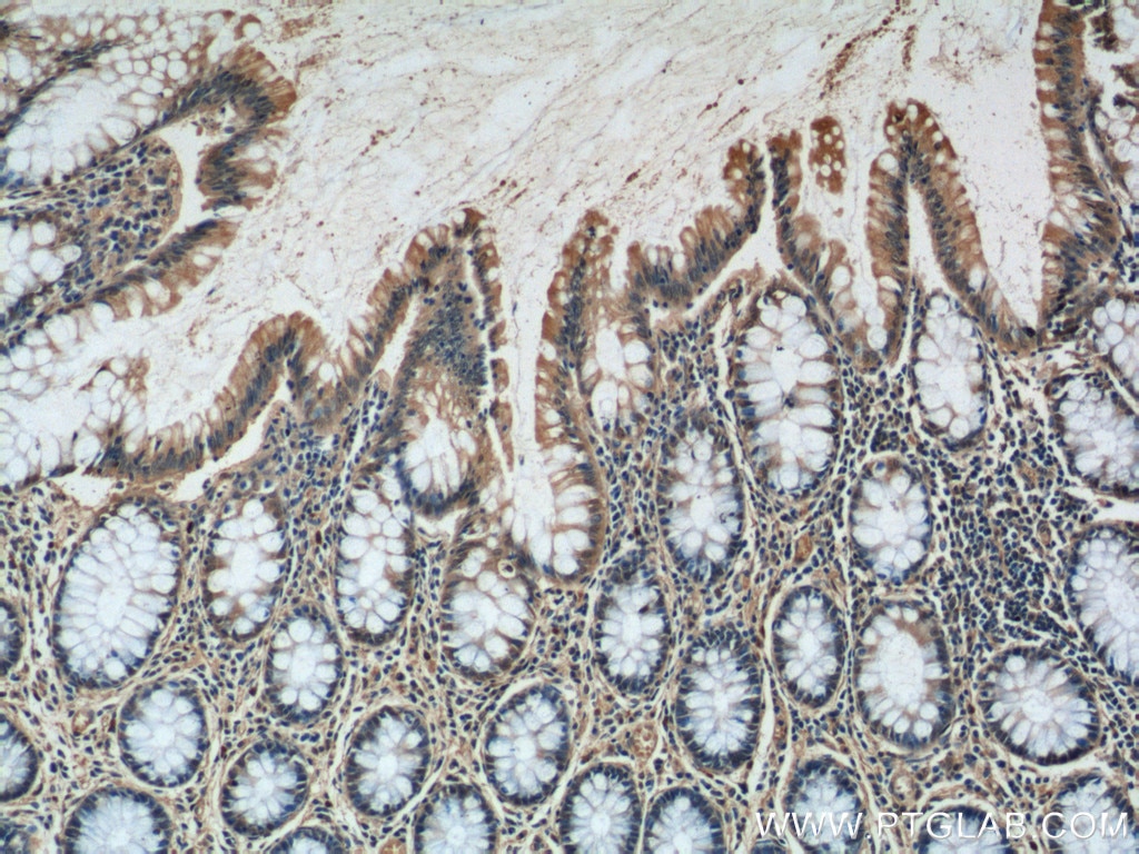 Immunohistochemistry (IHC) staining of human colon tissue using MRPL36 Polyclonal antibody (16625-1-AP)