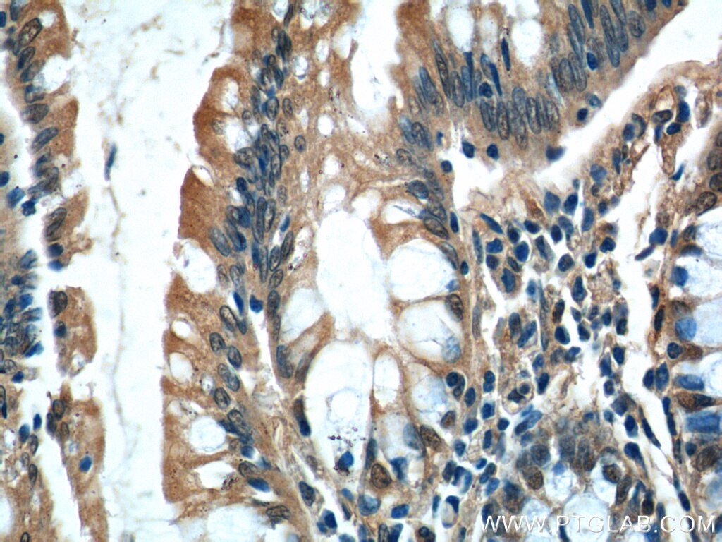 Immunohistochemistry (IHC) staining of human colon tissue using MRPL36 Polyclonal antibody (16625-1-AP)