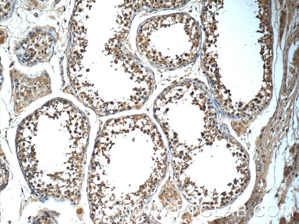 Immunohistochemistry (IHC) staining of human testis tissue using MRPL36 Polyclonal antibody (16625-1-AP)