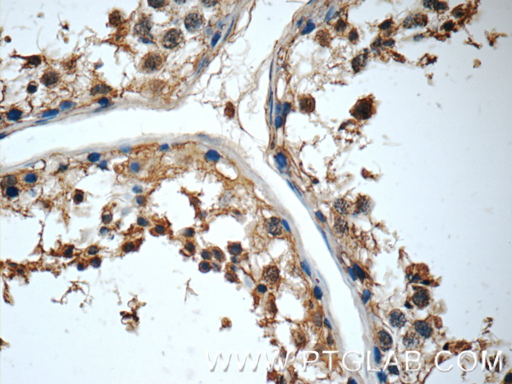 Immunohistochemistry (IHC) staining of human testis tissue using MRPL36 Polyclonal antibody (16625-1-AP)