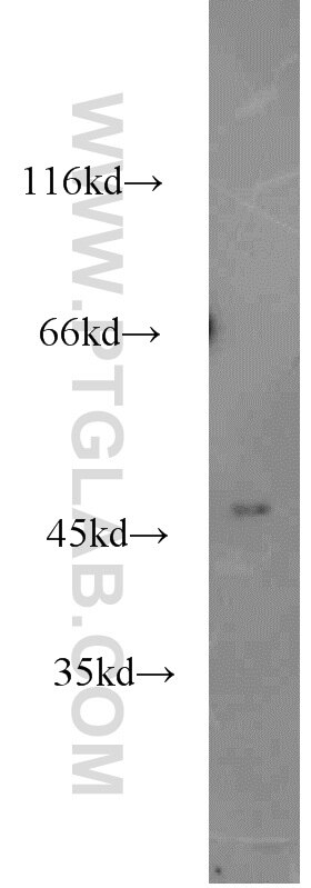 Western Blot (WB) analysis of human heart tissue using MRPL37 Polyclonal antibody (15190-1-AP)