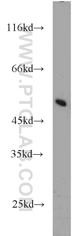 Western Blot (WB) analysis of mouse liver tissue using MRPL37 Polyclonal antibody (15190-1-AP)