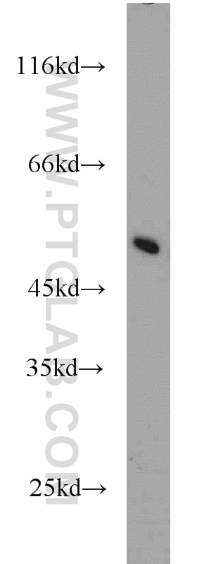 WB analysis of mouse liver using 15190-1-AP